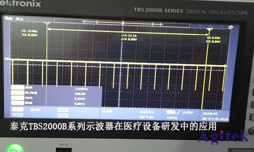 泰克TBS2000B系列示波器在医疗设备研发中的应用(图1)